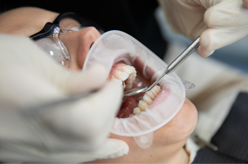 allcare, periodontia