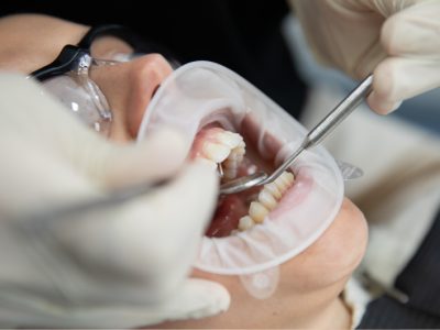 allcare, periodontia