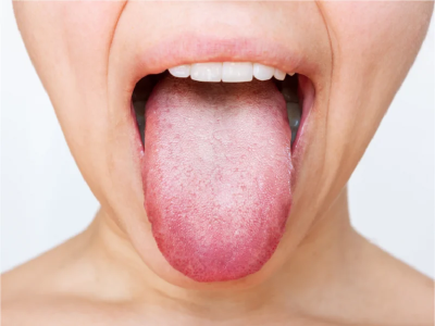 Tratamentos allcare, clinica de medicina dentária, allcare